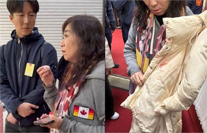 快新聞／林宜瑾被陳玉珍重摔掛彩「外套都是血」　怒控：用鋼頭鞋猛踩我下腹