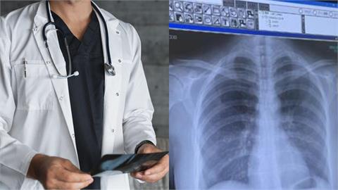 29歲鮮肉狼醫「噁闖病房」狂攝 2度誆女高中生「逼脫衣」照X光!