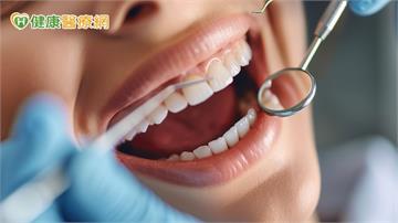 從牙周病看心臟健康？研究揭「1口腔細菌」與主動脈瓣膜狹窄潛在關聯
