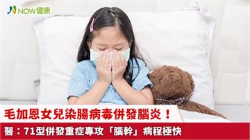 毛加恩女兒染腸病毒併發腦炎！ 醫：71型併發重症專攻「腦幹」病程極快