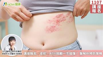 講座報名／皮蛇、RSV挑戰一次搞懂！ 醫解析預防策略
