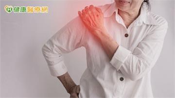 60婦肩膀抬不起來誤當五十肩　一檢查竟是旋轉袖肌腱破裂