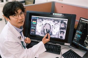 攝護腺癌治療升級　亞東醫院：SBRT縮時更精準