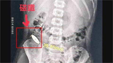 離譜！６歲童被小五生「逼吞3公分磁鐵」　補習班涉三項違規遭開罰