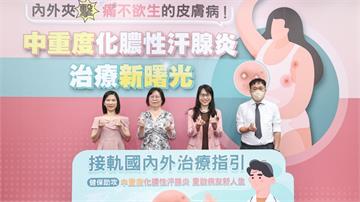 10多處爆膿如針刺！皮膚像「蟻窩」 化膿性汗腺炎7月起給付生物製劑！