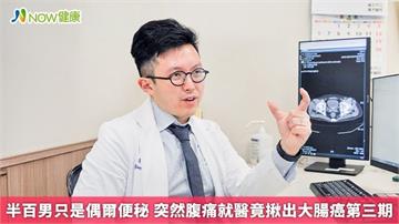 半百男只是偶爾便秘 突然腹痛就醫竟揪出大腸癌第三期