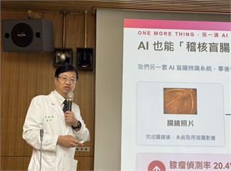 大腸鏡多花0.8分鐘更救命！   台大證實「AI輔助多揪8癌前病變」