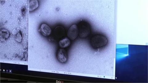 「M痘」疫情升級國際公衛緊急事件　疾管署調升剛果等7國旅遊警示
