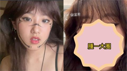 梧桐妹臉蛋「腫胖一圈」發腮了！深夜上傳「超晃畫面」同框男身分曝