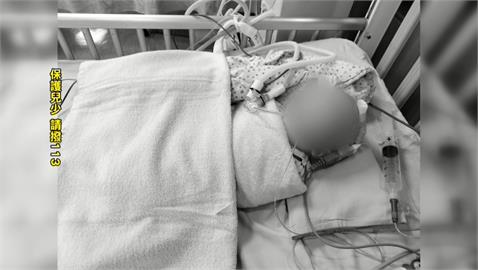 5月大男嬰顱內骨折出血　保母否認虐被收押了