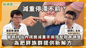 臺大醫院引進新型微創減重技術　「雪靴夾胃折疊術」納入輕中度肥胖治療新選擇