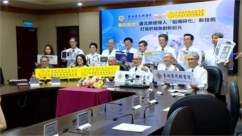 臺北榮總導入「組織碎化」新技術　打造肝癌無創治療新紀元