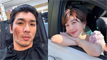 吳政澔《豆腐媽媽》毀容傷疤太逼真！王晴失手摔地上 他慘叫「我的皮」全場笑翻