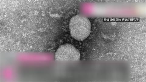 日研究曾染「原始病毒」患者　體內現變異株中和抗體