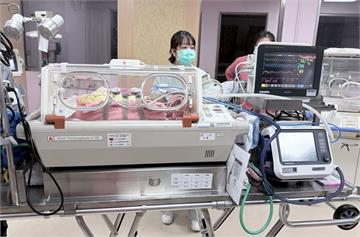 她三度早產     懷孕28周落紅！醫護深夜接力搶救1320克新生兒