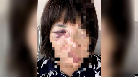 違規釣魚遭勸阻　火爆釣客毆傷女管理員遭逮
