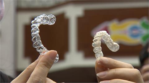 花12萬矯正「牙套疑變質」！　歐耐恩被爆無醫療器材許可證