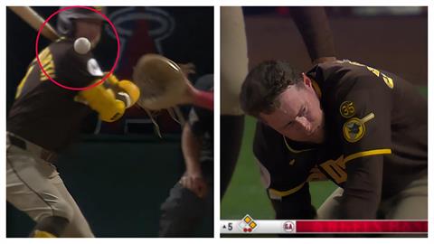 MLB(影)／155公里火球失控直衝打者臉部！驚悚觸身球嚇壞打者、捕手、主審三人