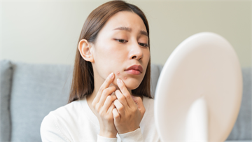 年前變美大作戰！ 新的一年直球對決「凹痘型痘疤」，醫曝1技術兼顧消疤痕、改善膚質