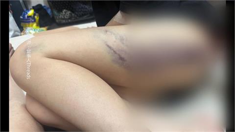 直播主率眾衝宿舍毆打員工！　1男1女宿舍慘遭毒打