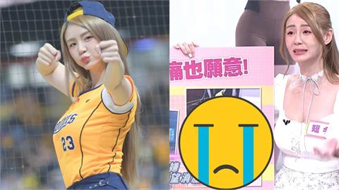 被球迷嫌腿粗！啦啦隊女神短今狠砸20萬「刮腿碎脂肪」驚人瘀青照曝光