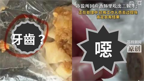 中國女吃香腸驚見「3顆牙齒」！燒賣再爆藏「連體人齒」網嚇瘋：不會是活摘器官？