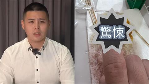 閩南狼「沒去花蓮救災」回應了！崩潰曬「腐爛發黑」食指：痛到叫不出來