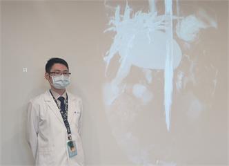 家長留意！1歲童腹脹嘔吐3天   罕見「先天性膽管囊腫」增癌風險
