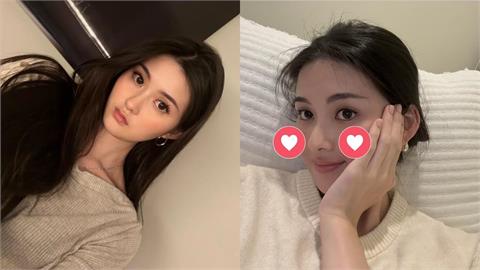 孫芸芸愛女卸妝後臉頰突「一片紅」　玫瑰斑發作她親吐「真實病情」