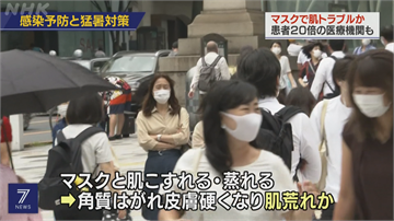 日本迎來高溫酷暑 戴口罩悶熱引發肌膚不適就醫潮