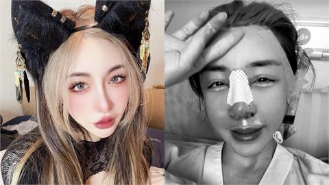 雪碧「12年假鼻」不要了！才爆「整形失敗」飛上海求醫⋯虛弱插管照流出