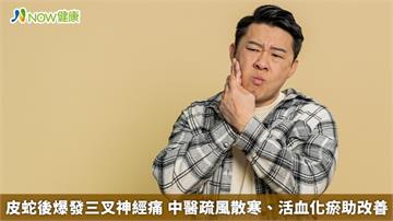 皮蛇後爆發三叉神經痛 中醫疏風散寒、活血化瘀助改善