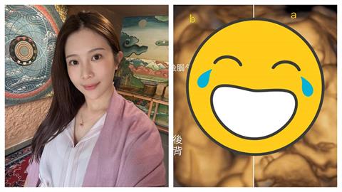 鄭家純懷胎16週爆身材「1變化」！曬超音波「雙寶做1姿勢」：在安慰我