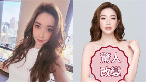 許維恩罹癌「切除雙乳」手術11小時後首發聲！身上出現「1重大變化」