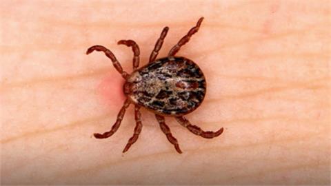 去日本旅遊要注意！「蜱蟲傳染病」疫情創新高…專家示警：嚴重恐器官衰竭亡