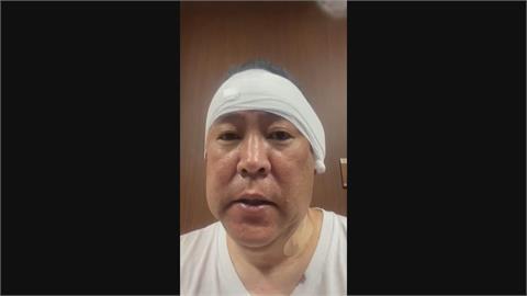 日本黨魁街頭遭砍耳朵流血 男性兇嫌已被逮捕