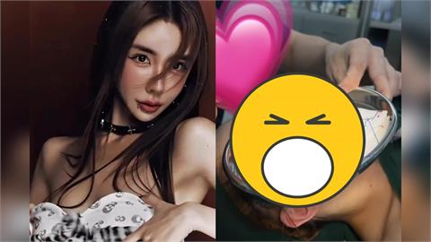 雪碧「全臉超腫」又飛上海整型！頭頂變形「拉出20多條異物」驚悚畫面曝	