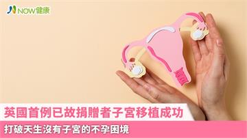 英國首例已故捐贈者子宮移植成功 打破天生沒有子宮的不孕困境