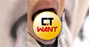 罹牙周病狂灌漱口水！每天6次慘變「黑舌」整條毛茸茸　畫面超驚悚