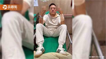 夜店大亨遇襲濺血!夏天倫遭砍15公分刀傷:為朋友擋一刀