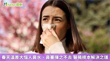 春天溫差大惱人鼻水、鼻塞揮之不去 醫揭根本解決之道