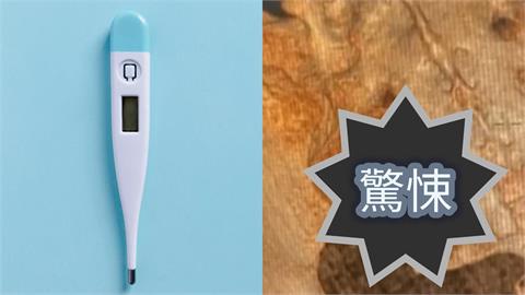 女子屁股驚見「2cm體溫計殘片」！深藏「22年不知情」醫師見1幕嚇壞