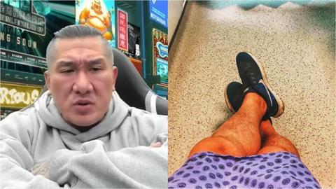 館長快看！他自爆罹1病「GG僅2.5公分」要申請世界紀錄：讓同類男性不孤單