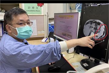 車禍沒外傷兩天才就醫   男不知「肋骨斷四根、脾臟破裂」險丟命！