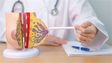 7成乳癌患者的惡夢！「最溫柔乳癌」卻也最容易復發，醫籲：快介入1藥物降低風險