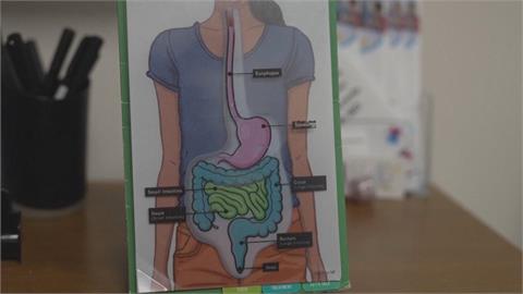 優格泡菜等發酵食品助消化　專家：讓腸道菌群平衡