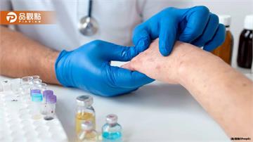 休假回越南！女交換生纏綿男友　回台發現「染梅毒」