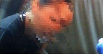 臘腸犬突襲飼主額頭撕裂！　嘉義女子家中慘遭愛犬咬傷