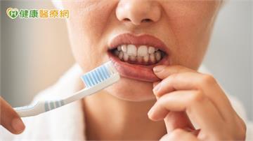 刷牙太用力反傷害牙齦 專家提醒:正確潔牙應細緻、持之以恆、用對工具