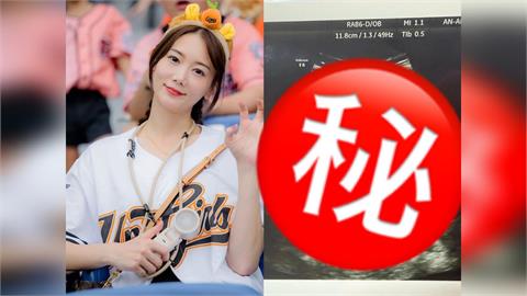 啦啦隊女神報喜懷二胎！深夜曬超音波　曝「1原因」直言內心忐忑